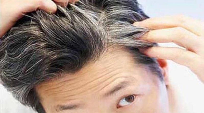 Algunos de los factores que intervienen en la aparición de las canas prematuras son la genética, el estrés y las deficiencias nutricionales, entre otras. (Lee también: Utiliza verdura para aliviar el dolor al amamantar) Si tu cabello ya tiene sus primeras hebras blancas, te conviene saber que, además de los anteriores detonantes, su origen puede estar relacionado una enfermedad autoinmune. ¿Cuál? El vitiligo. Esta enfermedad provoca la pérdida de melanina, pigmento de algunas células del cuerpo, cuya función es la coloración de la piel, ojos y cabello. Si quieres eliminar las canas de tu cabello, prepara este efectivo remedio casero: Ingredientes: - 3 cucharadas de vinagre - 1 vaso de agua Prepáralo así: Vierte en un refractario el vaso de agua, agrega las tres cucharadas de vinagre y revuelve. Aplica la mezcla sobre tu cabello (con la yema de tus dedos), deja actuar 30 minutos y enjuaga con agua tibia.